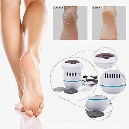 Pedi vac Callus Remover